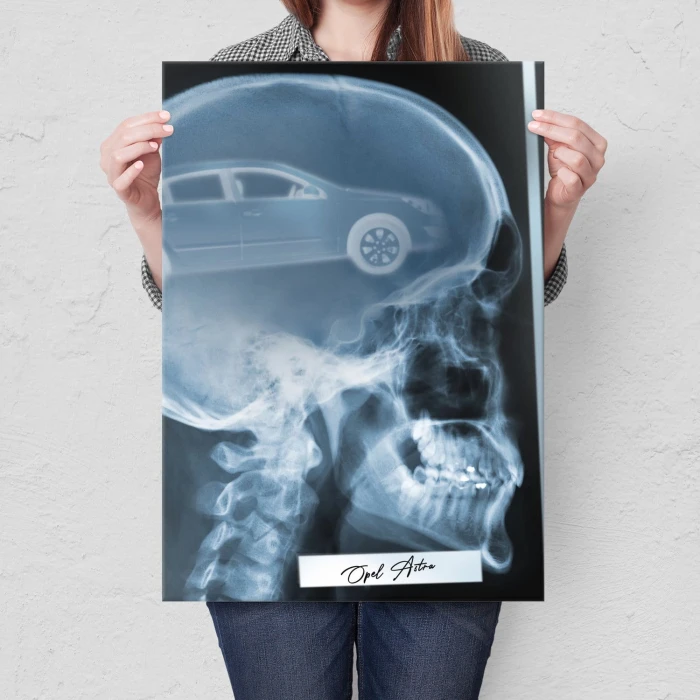 Poster metal Rentgen Opel Astra H gift