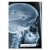 Plakat metalowy Rentgen VW Golf III