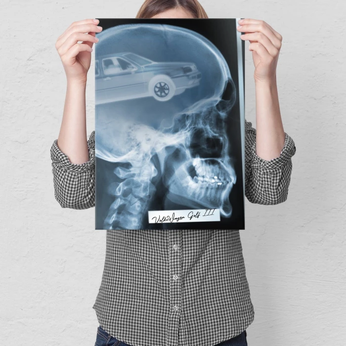 Poster metal Rentgen VW Golf III