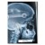 Poster metal Rentgen Ford Focus II gift