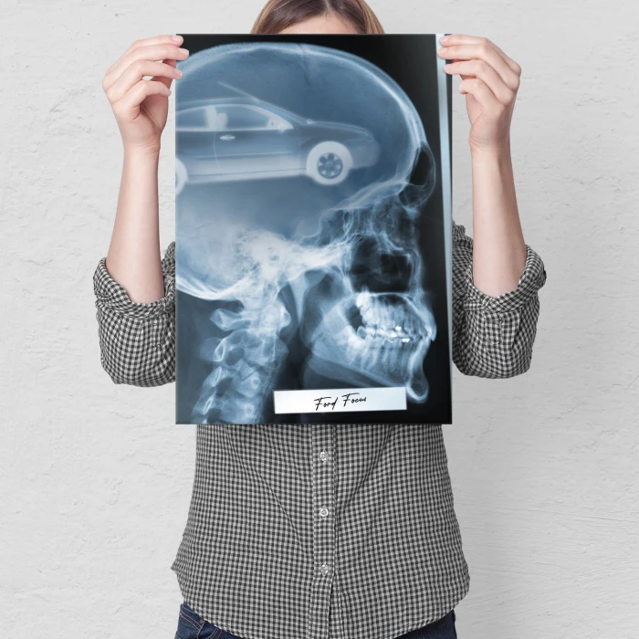 Poster metal Rentgen Ford Focus II gift