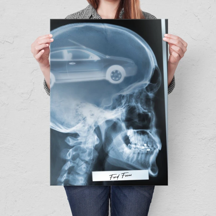 Plakat metalowy Rentgen Ford Focus II Prezent