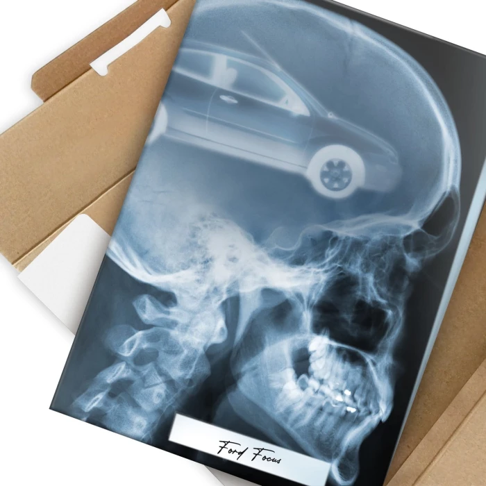 Poster metal Rentgen Ford Focus II gift