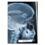 Poster metal Rentgen Ford Focus III gift