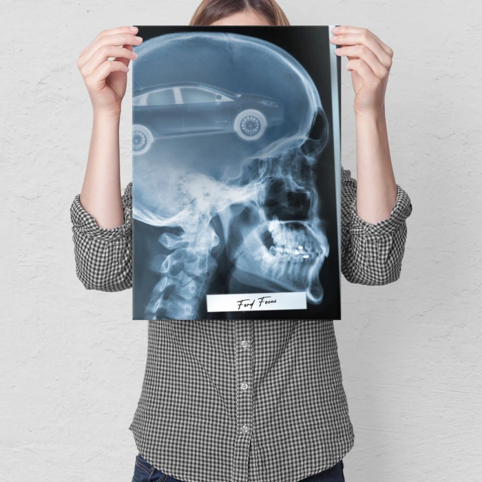 Poster metal Rentgen Ford Focus III gift