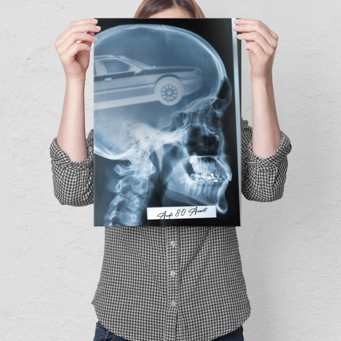 Plakat metalowy Rentgen Audi 80 Prezent
