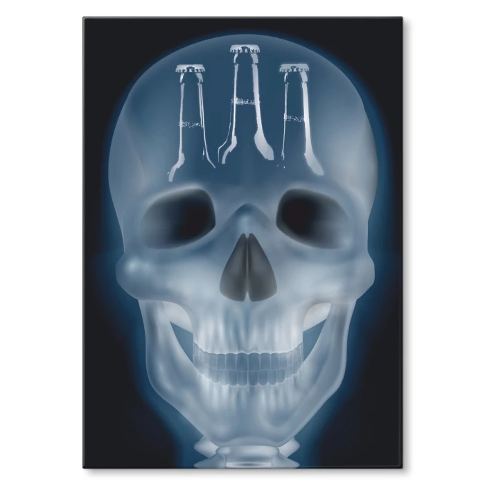Poster metal xray beer gift